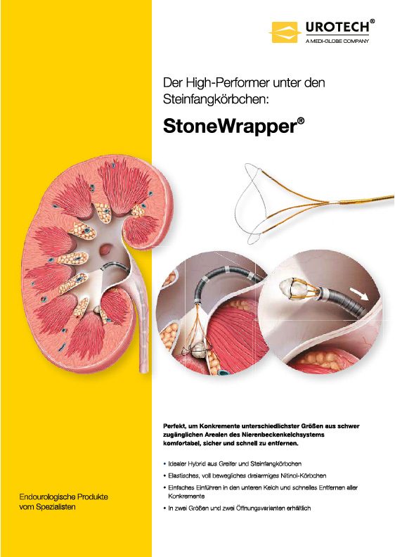 StoneWrapper Flyer DE